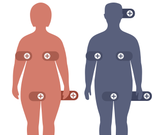 Location of lesions Hidradenitis suppurativa location of lesions underarm
