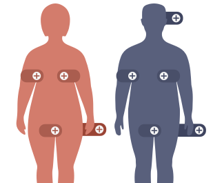 Hidradenitis suppurativa location of lesions underarm